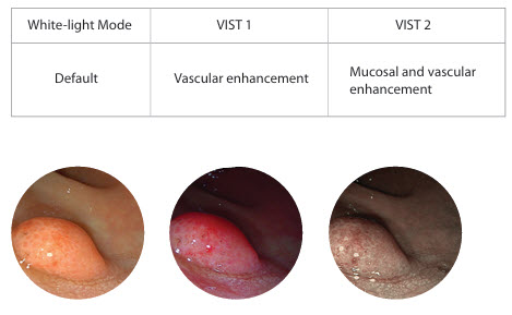 Video Endoscope System V3